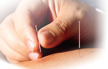 Acupuncture For Cleveland Acupuncture Clinic